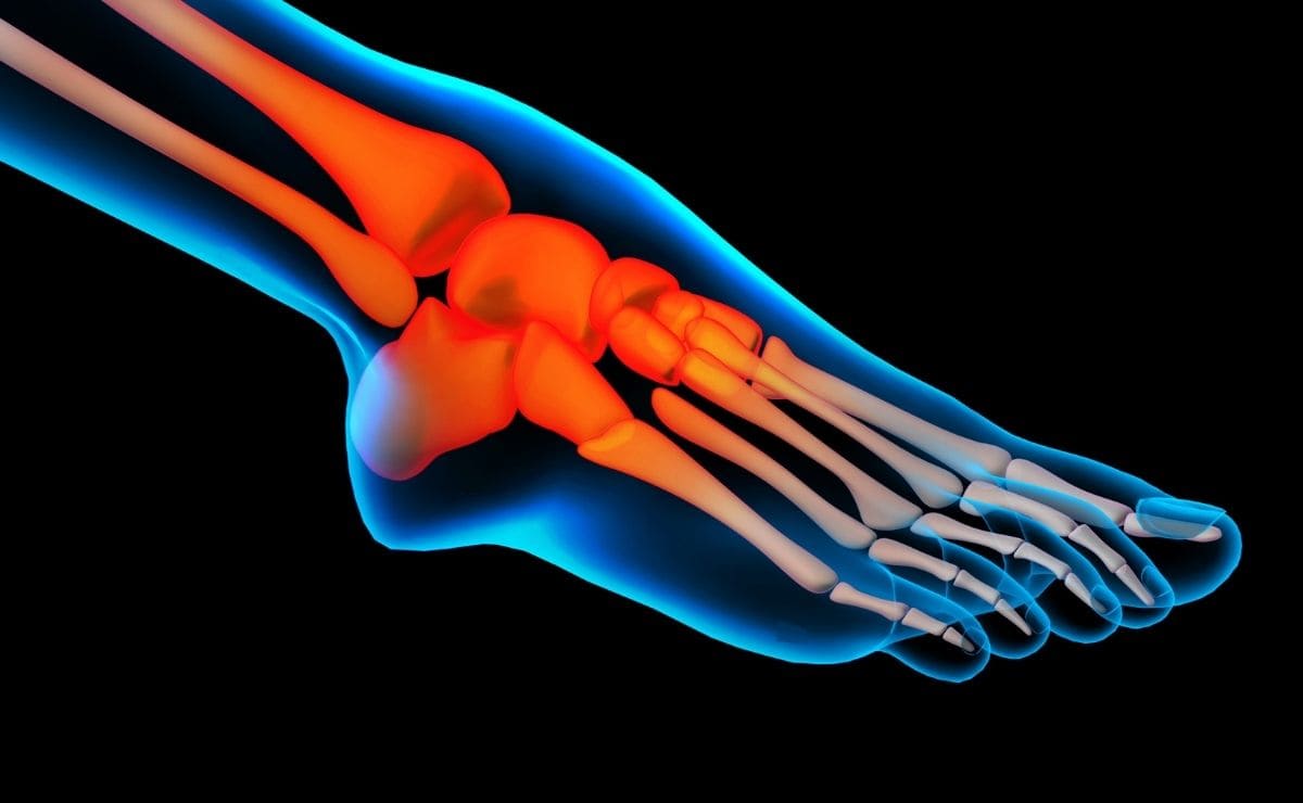 the-5-health-consequences-of-gout-and-high-uric-acid